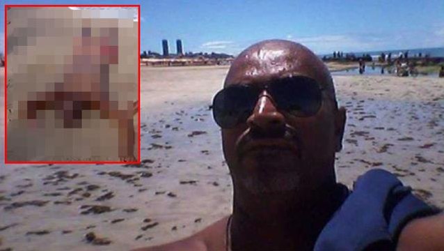 Köpek balığı dehşeti! Tuvaletini yapmak isteyen adamın kolunu ve cinsel organını kopardı