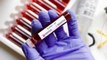 India's first Covid patient tests positive again for coronavirus