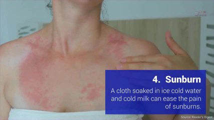 5 surprising milk home remedies