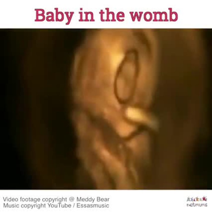 Baby in the womb!