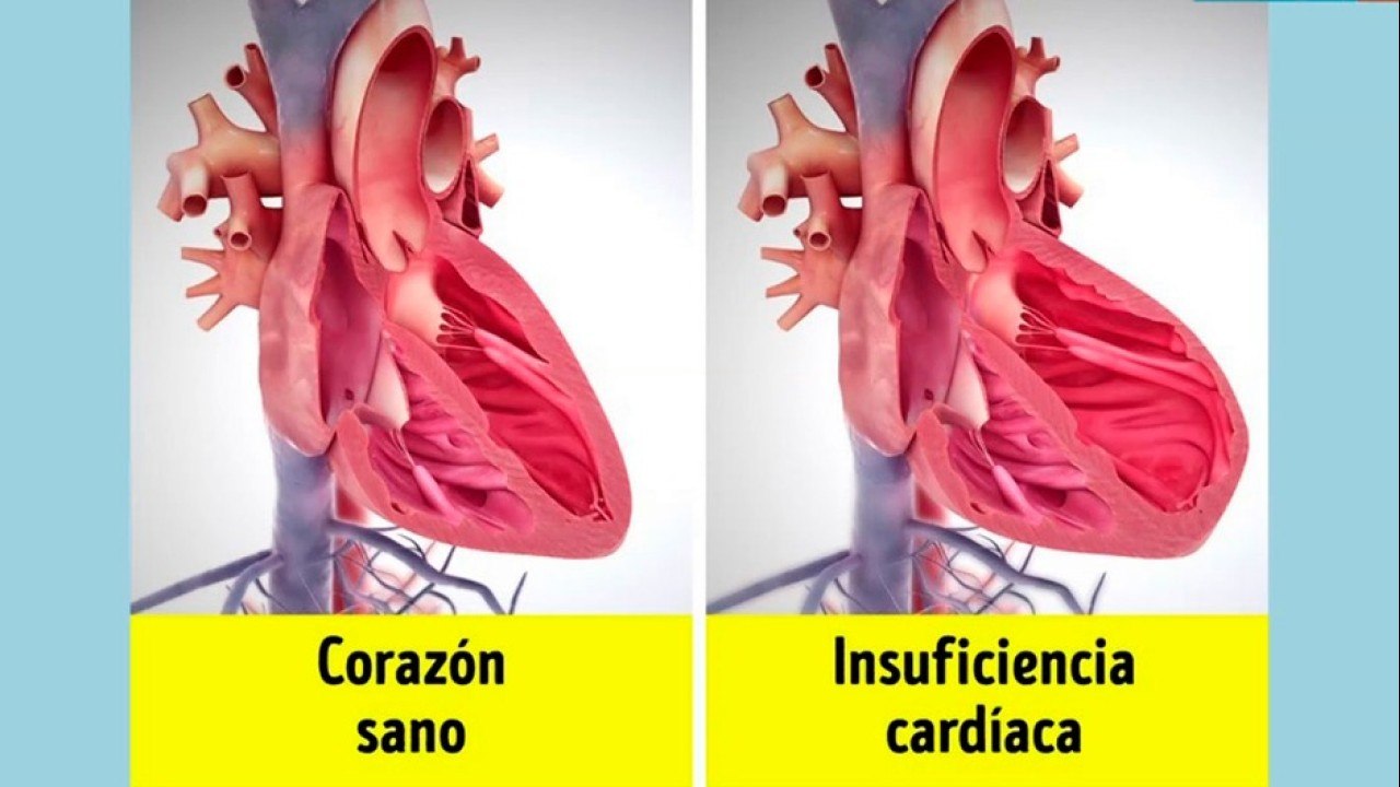 bd-señales-que-podrian-alertar-de-insuficiencia-cardiaca-130721
