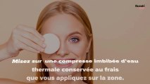 Que faire pour ne pas avoir les yeux gonflés le matin