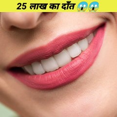 25 lakh ka (दांत) teeth | OMG  #shorts #facts