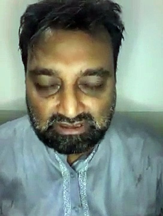 NAZR E BAD KA ILAJ