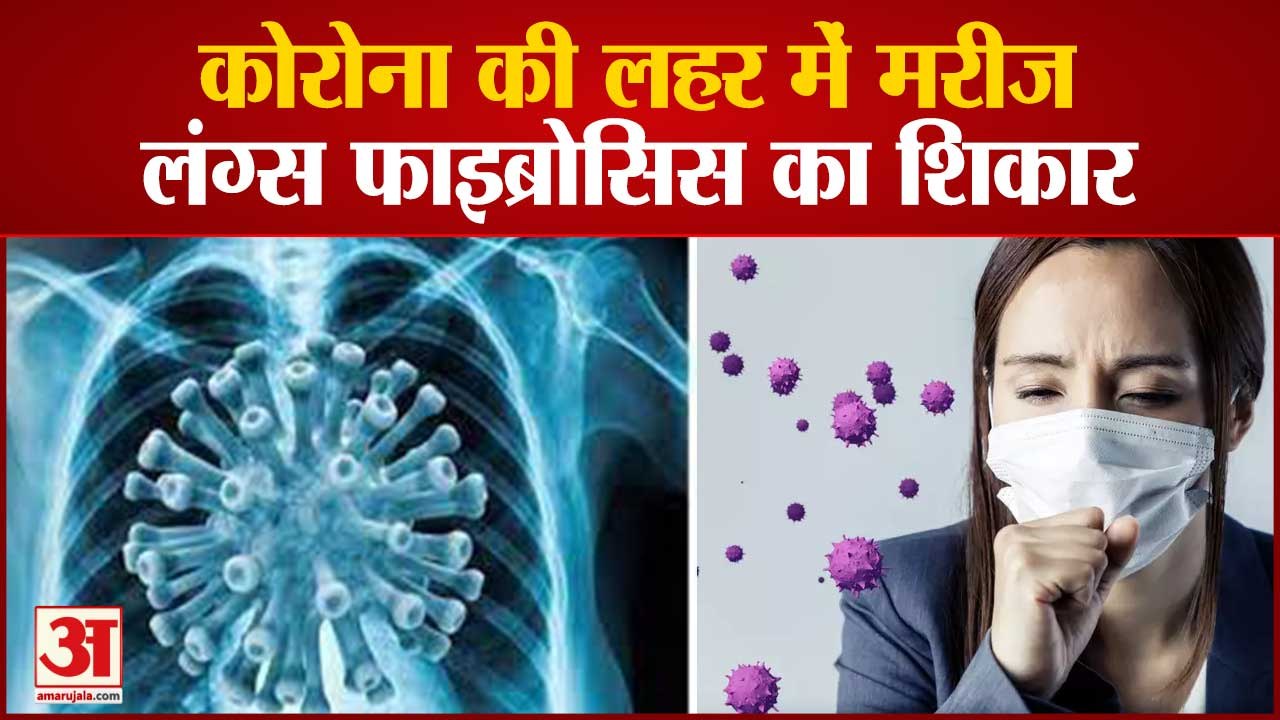 सावधान रहिए ! मरीज हो रहे Lung Fibrosis का शिकार | | Patients Suffering from Lungs Fibrosis