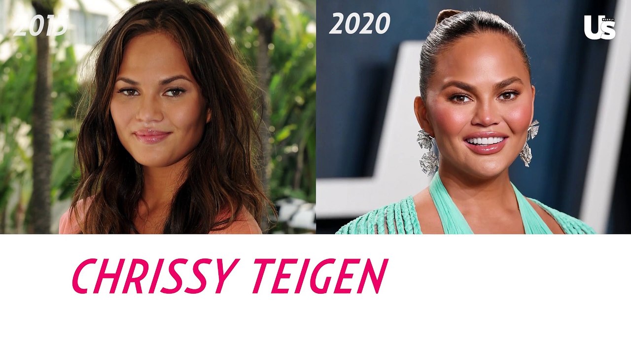 Angelina Jolie & Jennifer Lopez Plastic Surgery...