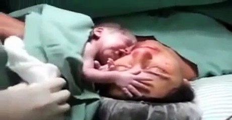 Yeni doğmuş bebek annesinden ayrılmak istemiyor!