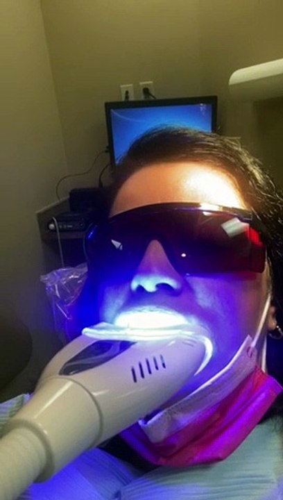 Teeth Whitening Phoenix AZ | Zoom Whitening