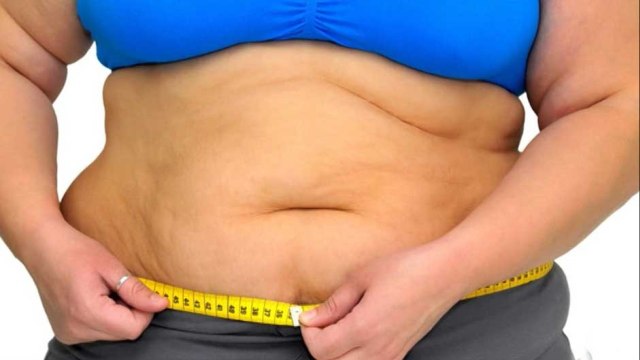 bd-quienes-son-candidatos-a-cirugia-bariatrica-160721