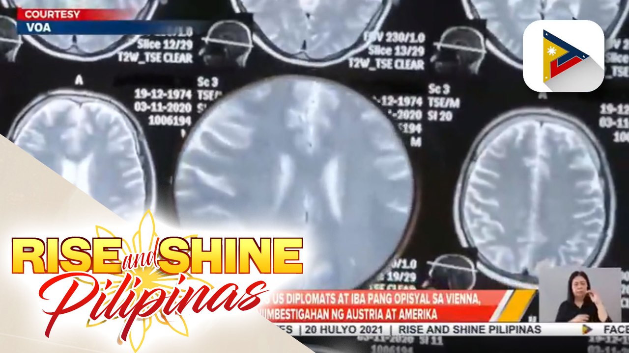 Pagkakaroon ng ''havana syndrome'' ng mga opisyal ng US at Austria, masusi nang iniimbestigahan