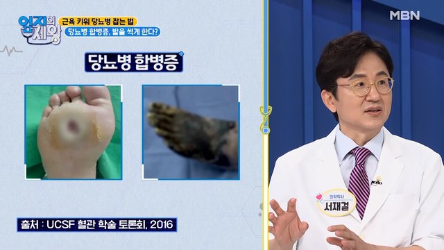 ※충격※실명 유발하는 당뇨 합병증! 발까지 썩게 한다?!