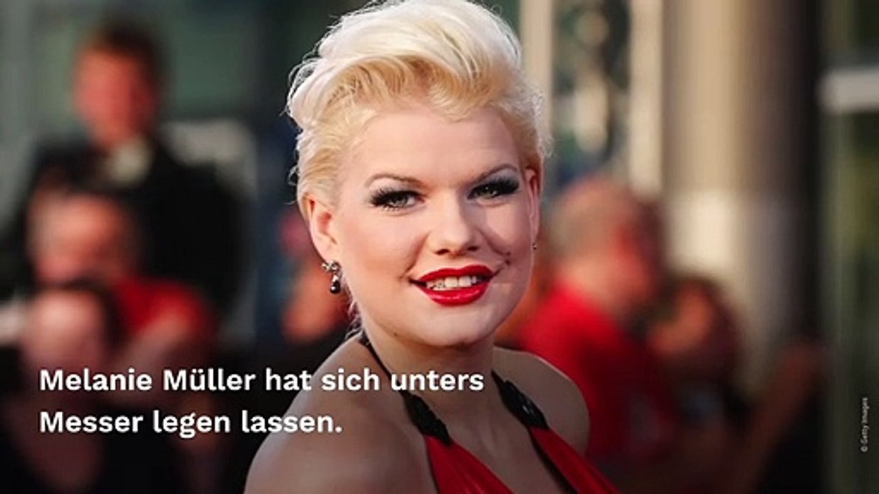 Melanie Müller: Nach Beauty-OP kaum wiederzuerkennen