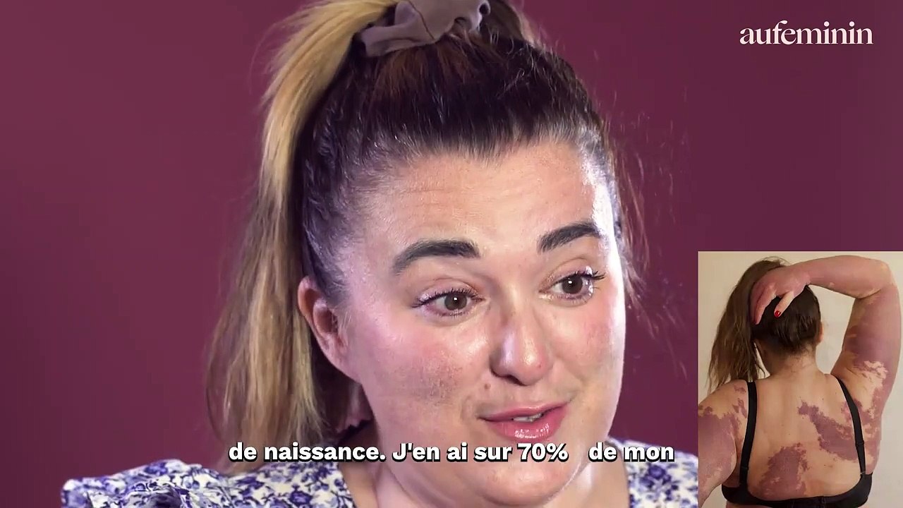 DECOMPLEXE.E - La fille qui a des tâches - Youtube