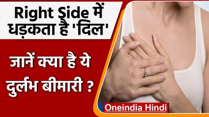 Viral News: Chest के right side में Heart, दुर्लभ बीमारी की शिकार है महिला । वनइंडिया हिंदी