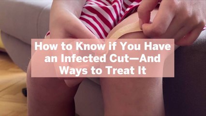 How to Know if You Have an Infected Cut—And Ways to Treat It