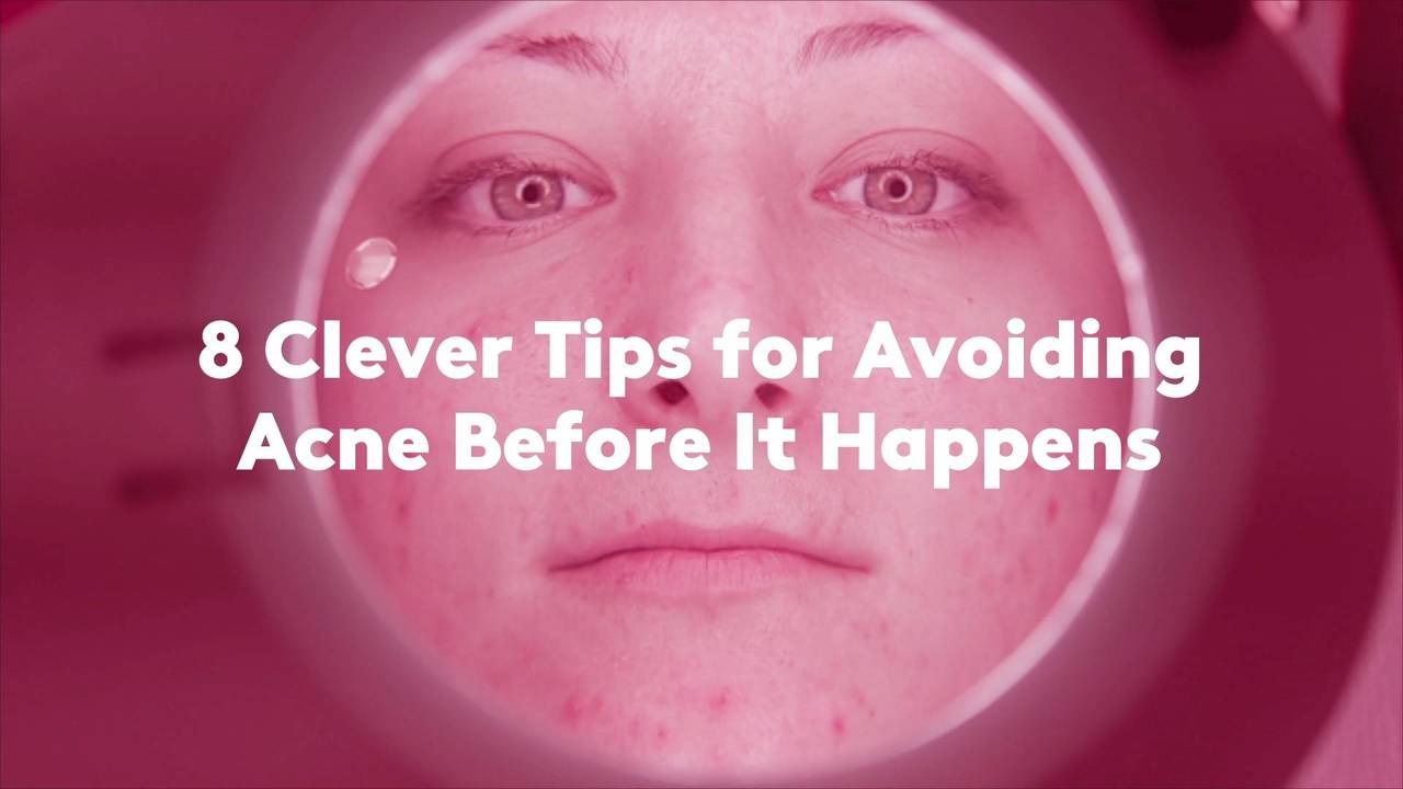 8 Clever Tips for Avoiding Acne Before It Happens