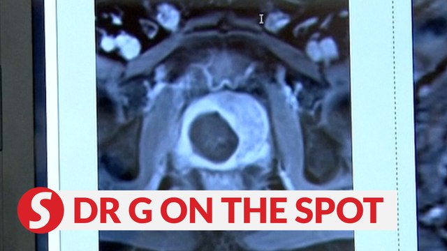 EP77: Early detection of prostate cancer key to continuous sex | PUTTING DR G ON THE SPOT