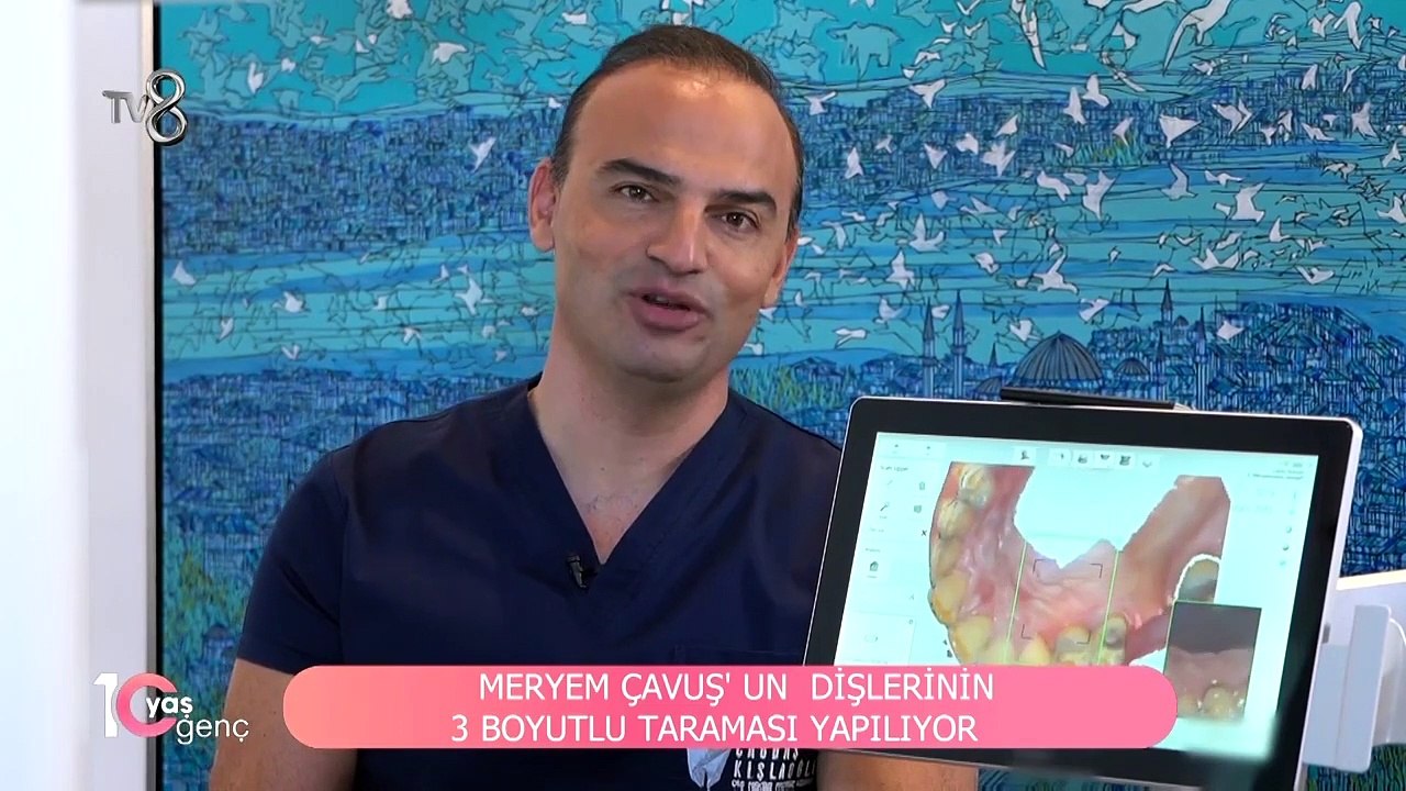 Dişlerdeki bozukluklara gülüş tasarımı ile son! | Smart Smile Design