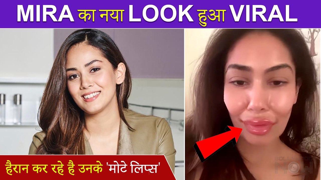 SHOCKING! Mira Rajput Went Under The Knife? | P...