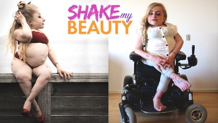 My Bones Of Glass Won't Stop Me Modelling | SHAKE MY BEAUTY
