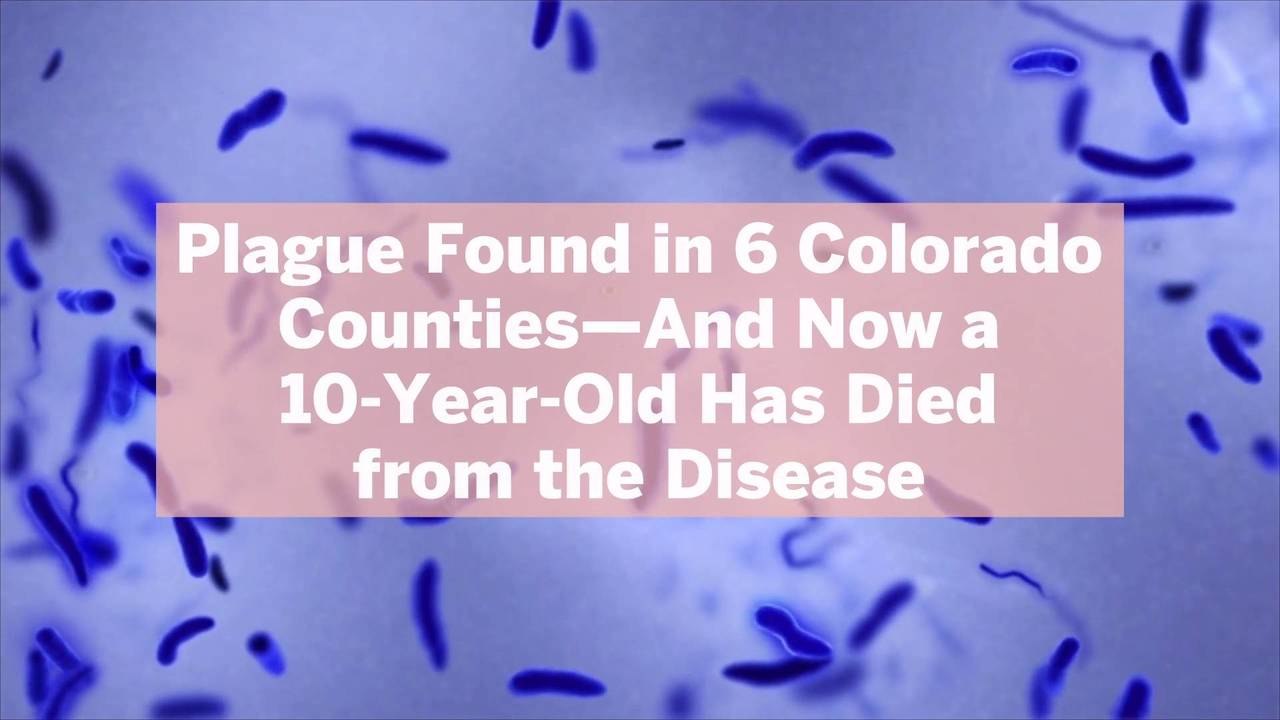 Plague Found in 6 Colorado Counties—And Now a 10YearOld Has Died from