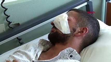 Yerde bulduğu havai fişeğin patlamasıyla gözünden yaralandı