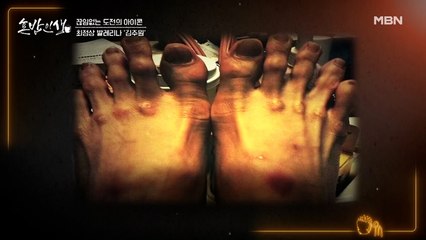 아름다움 뒤에 감춰진 발레리나 김주원의 상처투성이 발