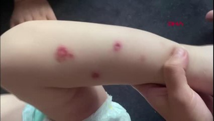 1,5 YAŞINDAKİ BEBEĞİNE İŞKENCE YAPTIĞI İDDİA EDİLEN BABAYA MEYDAN DAYAĞI