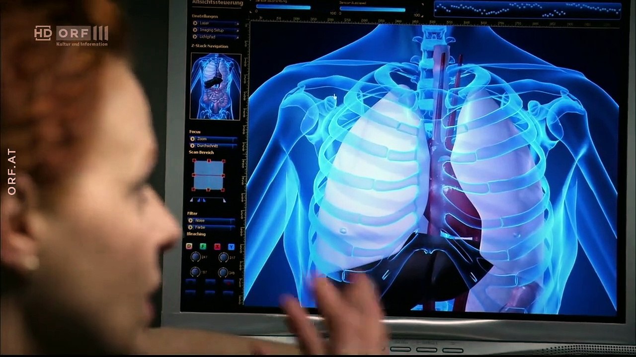 SOKO Kitzbühel: Dunkle Seiten | Folge 4/Staffel 13