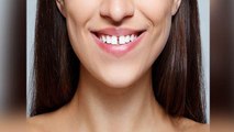 दांतों के बीच गैप वाली लड़कियां क्या सच में होती है भाग्यशाली ? | Boldsky