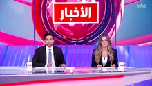 الإعلان عن نجاح عملية فصل التوأم الطفيلي اليمني في الرياض