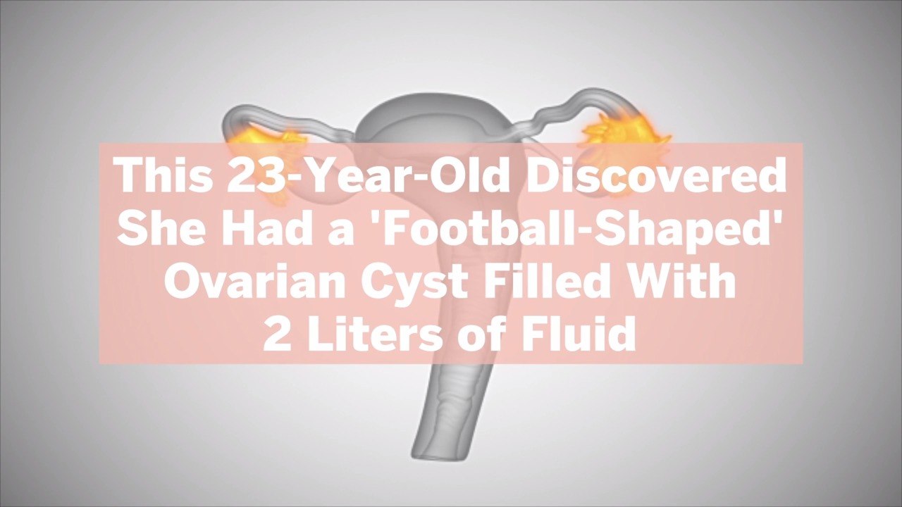 This 23-Year-Old Discovered She Had a 'Football-Shaped' Ovarian Cyst Filled With 2 Liters