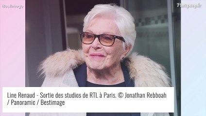 Tải video: Line Renaud a cédé à la chirurgie esthétique... et retouché son visage : 