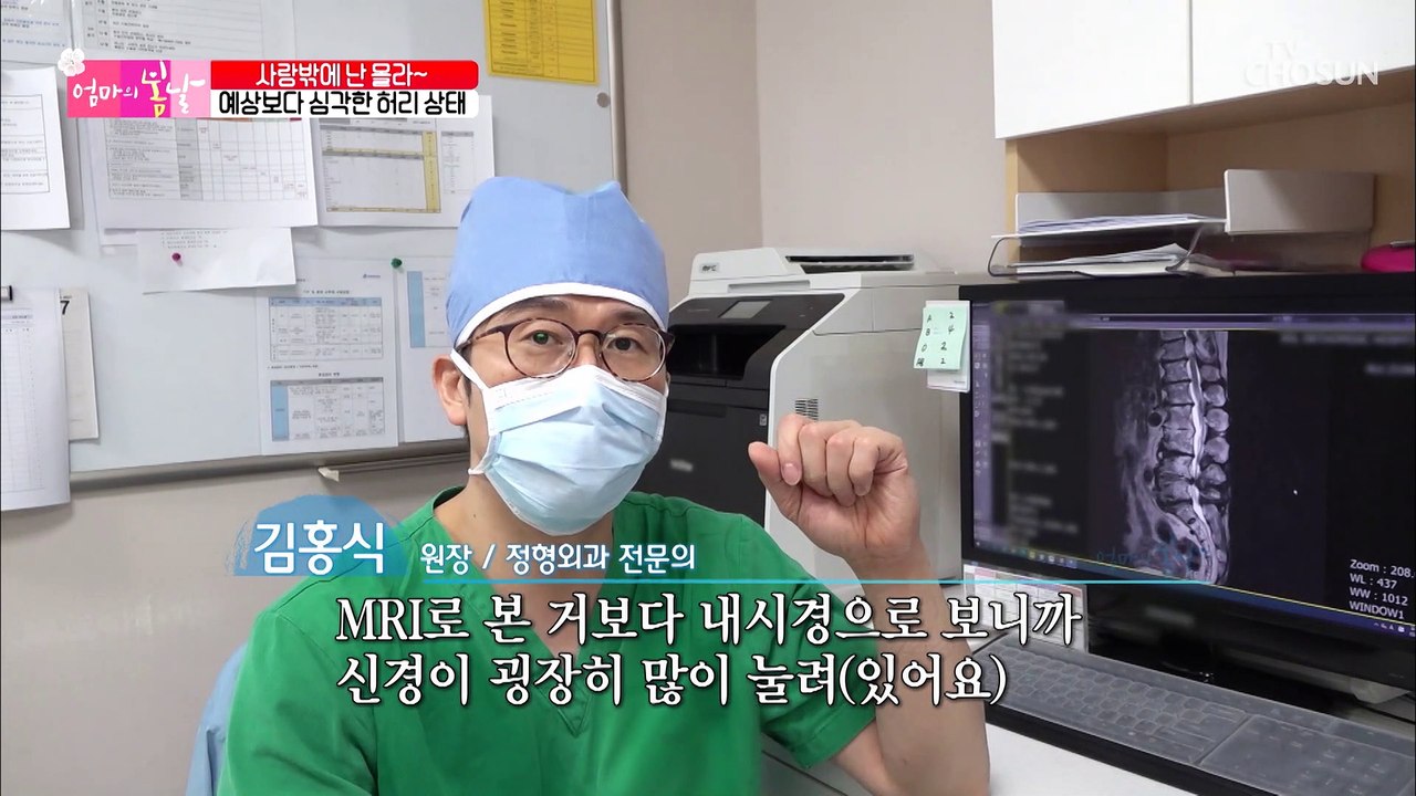 척추 내시경 수술 후 활짝 웃는 봉순 엄마☺ TV CHOSUN 20210801 방송