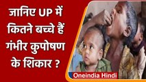 Malnutrition cases: Uttar Pradesh में कुपोषण पर क्या बोलीं Smriti Irani | वनइंडिया हिंदी