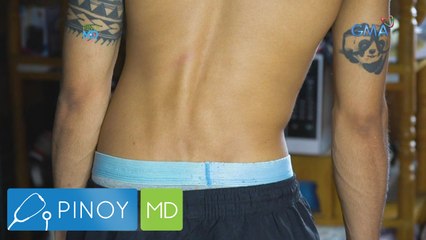 Pinoy MD: What is a herniated disk?