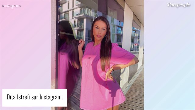 Dita Istrefi opérée après l'agression de son ex : photo choc de son visage abîmé