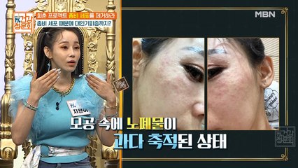 트로트 여전사 지원이, 대인 기피증 있었던 사연