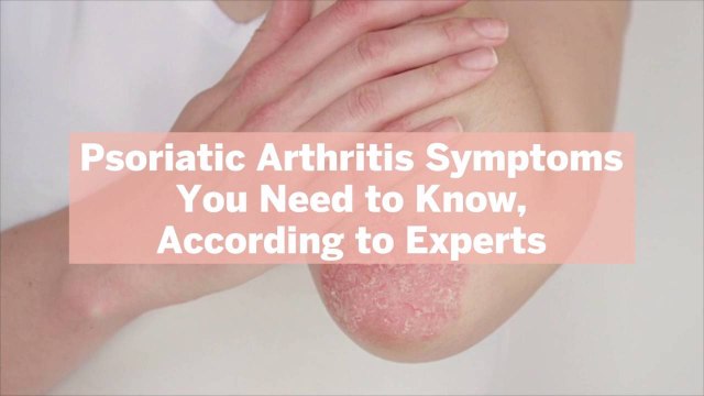 10 Psoriatic Arthritis Symptoms You Need to Know, According to Experts