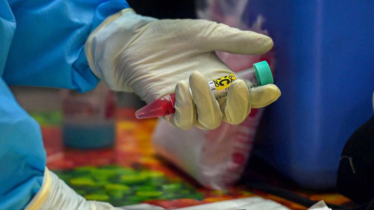 Maharashtra reports first Zika virus case, know the symptoms