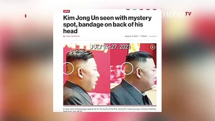 Penampakan Perban Misterius di Belakang Kepala Kim Jong Un Jadi Sorotan