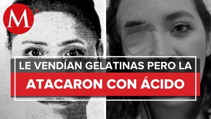 Dan a conocer video de agresora de Ana, le quemó la cara con ácido