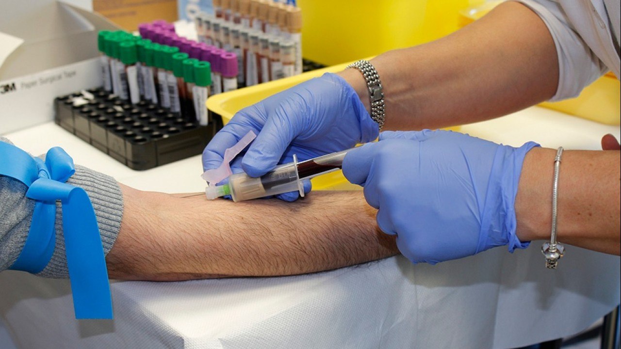 bd-complicaciones-de-la-anemia-si-no-se-trata-segun-sus-causas-040821