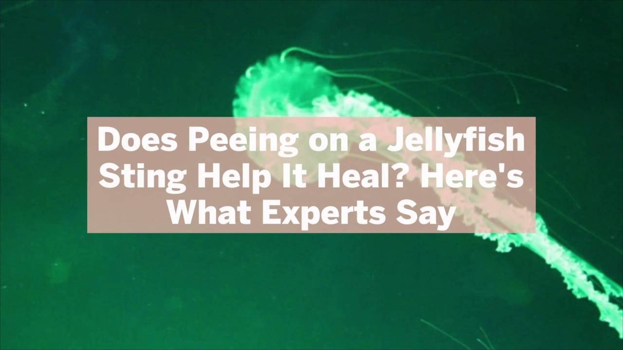 Does Peeing on a Jellyfish Sting Help It Heal? Here's What Experts Say