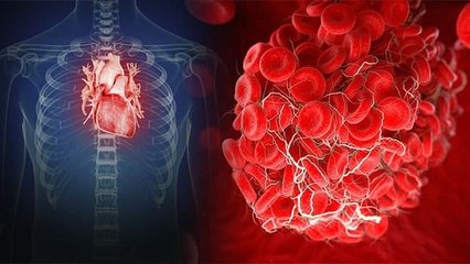 Heart में Blood Clotting के 5 कारण, Expert से जानें इसके लक्षण और इलाज । Boldsky