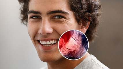 Wisdom Teeth निकलवाने से क्या Brain पर पड़ता है Effect, चौंकाने वाला खुलासा | Boldsky