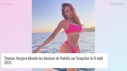 Nabilla couverte de boutons et de plaques rouges : elle dévoile des photos