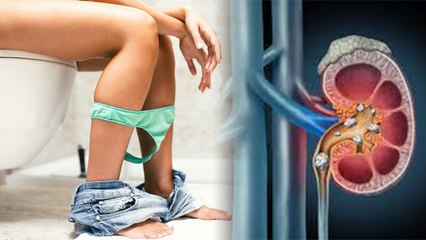 Kidney में Stone होने से क्या होता है, Symptoms ना करें नजरअंदाज | Boldsky