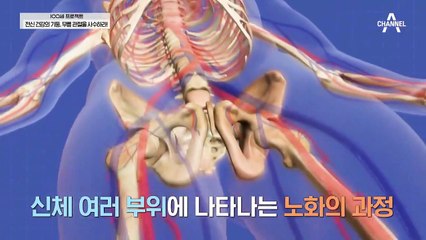 무릎에서 소리가 나면 퇴행성 관절염 4기?!