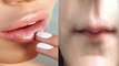 Lips बढ़ती उम्र के साथ क्यों हो जाते हैं पतले ? | Home Remedies for Thin Lips | Boldsky